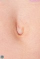 a close up of a person's stomach with a small lump on it